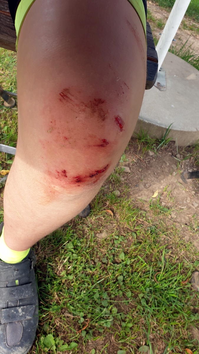 Knie